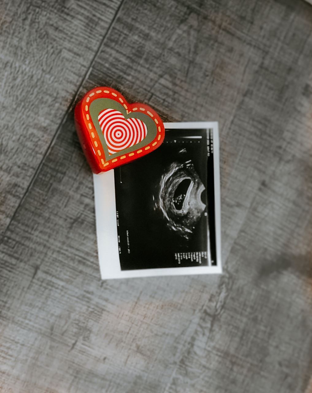 ultrasound photo of baby being pinned to a board with a heart shaped pin. Photo by Viviana Rishe on Unsplash.